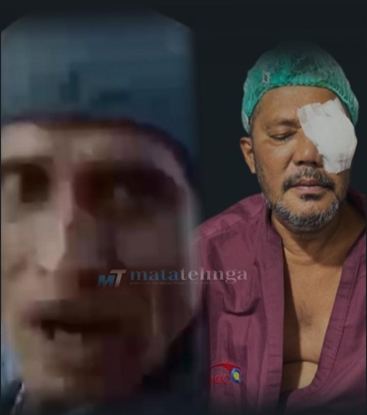 Terpidana Kasus Penganiayaan "Abdul Aziz Ray" Kabur, Kini Kejari Asahan Tetapkan DPO