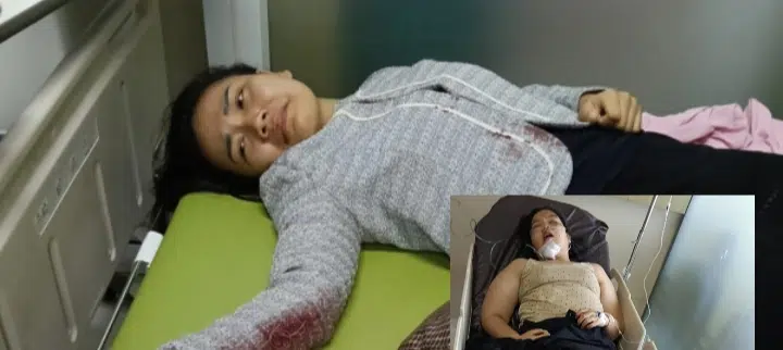 Dua Wanita Loncat Hingga Tak Sadarkan Diri, Akibat Apa...?