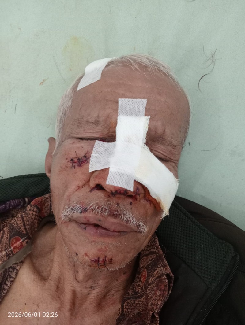 Kakek Lembam Dikeroyok Bapak dan Anak