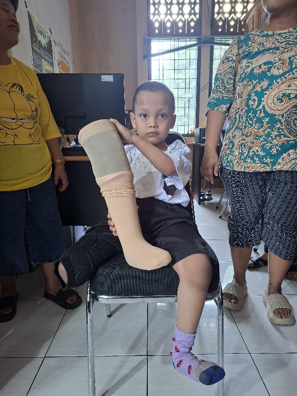 Srikandi Pena Nusantara Bersatu Apresiasi Respons Cepat Pemko Medan Berikan Kaki Palsu untuk Anak 7 Tahun